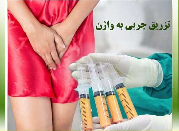 تزریق چربی به واژن چه عوارض و هزینه هایی دارد؟ - مرکز زیبایی لادن