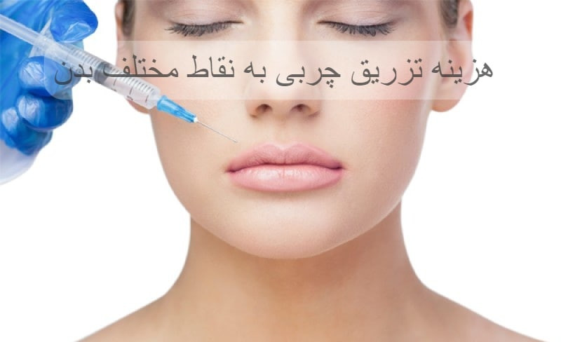 بررسی هزینه تزریق چربی به نقاط مختلف بدن - مرکز زیبایی لادن