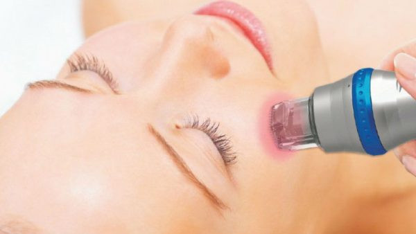 تعداد جلسات آر اف فرکشنال چقدر است؟