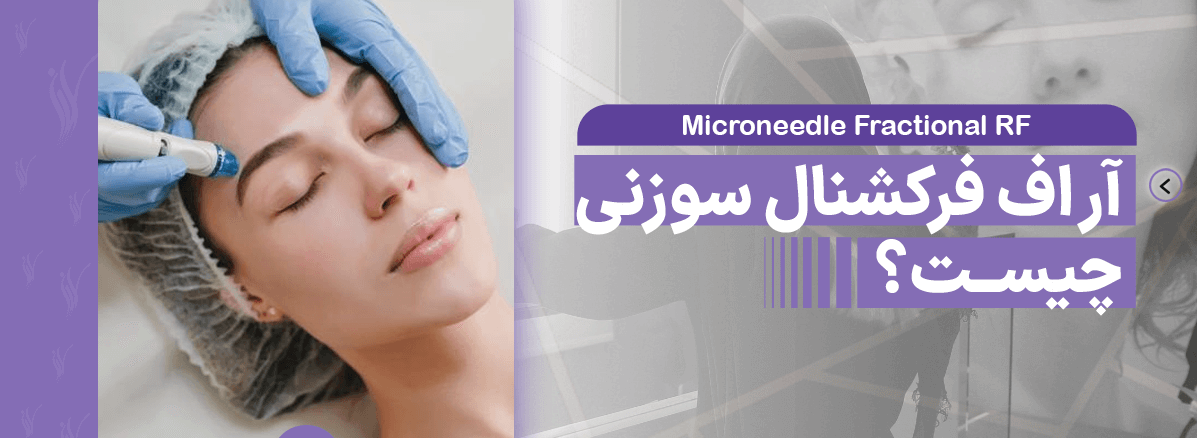 آر اف فرکشنال سوزنی چیست؟ کاربرد،مزایا ، و... - مرکز زیبایی لادن