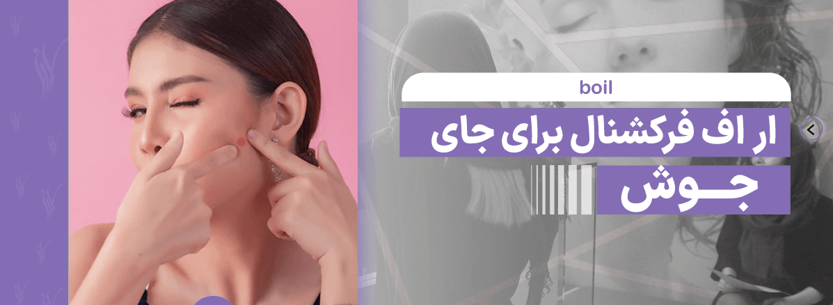 آر اف فرکشنال برای جای جوش کاربرد دارد؟ - مرکز زیبایی لادن