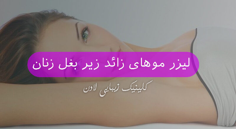 لیزر موهای زائد زیر بغل زنان چگونه است؟ - کلینیک زیبایی لادن
