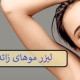 لیزر موهای زائد زیر بغل چگونه است؟ -کلینیک زیبایی لادن