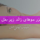 لیزر موهای زائد زیر بغل زنان چگونه است؟ - کلینیک زیبایی لادن