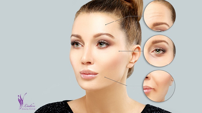 ترمیم بوتاکس چیست؟ چگونه انجام می شود؟ - مرکز زیبایی لادن