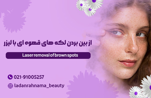 چگونه لک های قهوه ای جای جوش را با لیزر از بین ببریم؟ - مرکز زیبایی لادن 