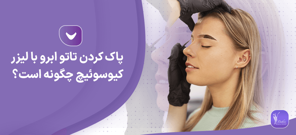 پاک كردن تاتو ابرو با ليزر كيوسوئيچ چگونه است؟