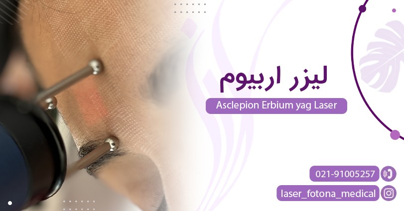 لیزر اربیوم در تهران با جدید ترین دستگاه - مرکز زیبایی لادن