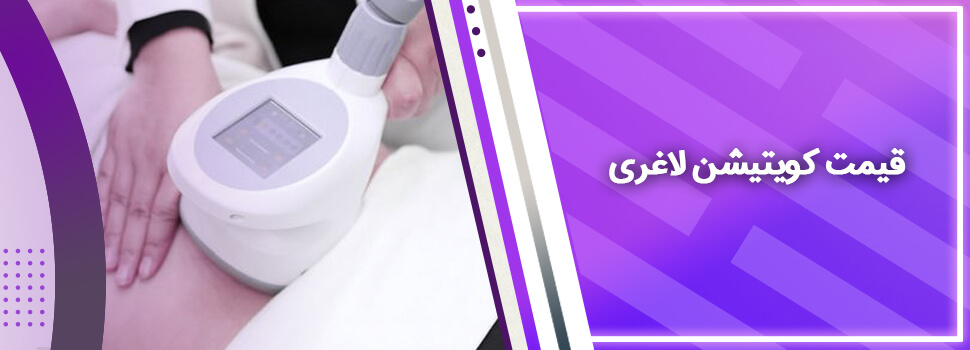 کویتیشن