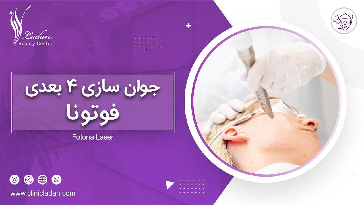 فوتونا