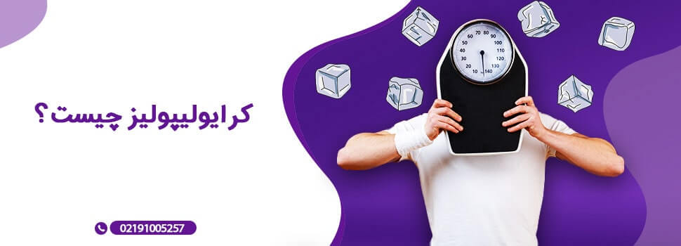 کرایولیپولیز