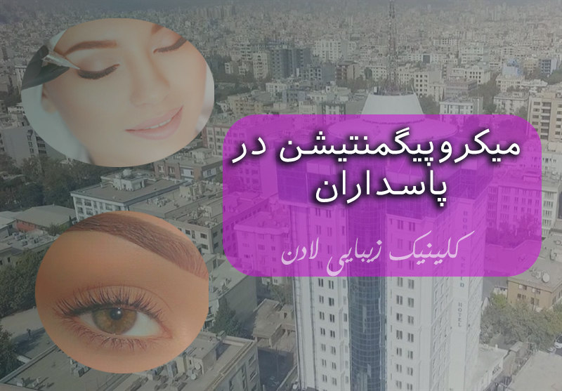 میکروپیگمنتیشن در پاسداران