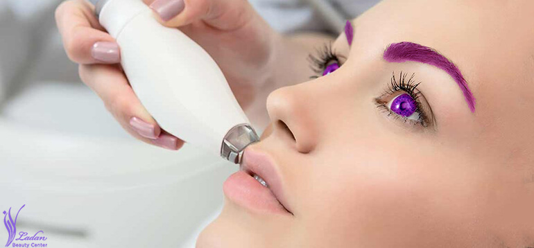 5 تفاوت هایفوتراپی با مزوتراپی