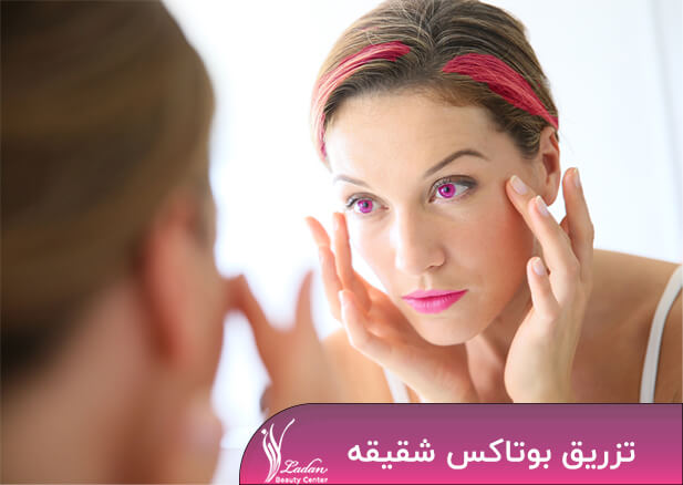 تزریق بوتاکس شقیقه - عوارض و مزایای ان