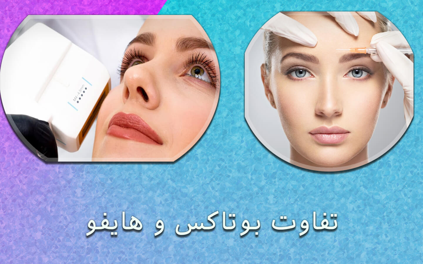 بوتاکس یا هایفو؟ کدام بهتر است + عوارض و مزایا - مرکز زیبایی لادن